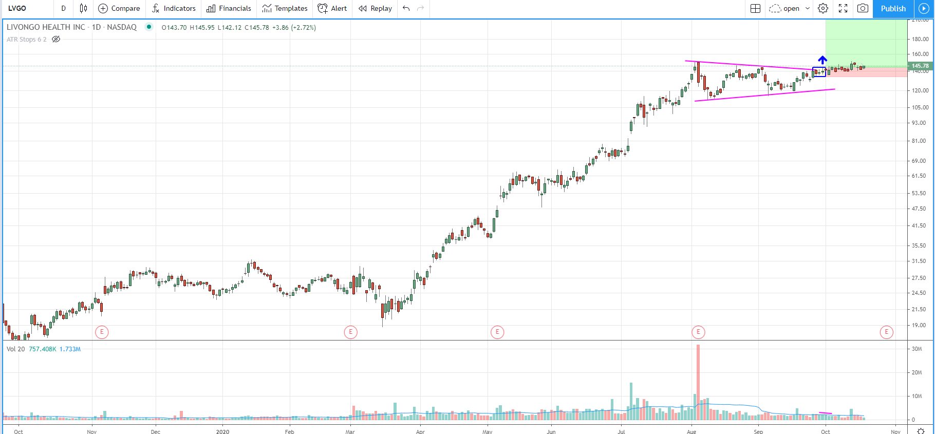 Swing Trading Patterns: How to Use the Best Chart Patterns for